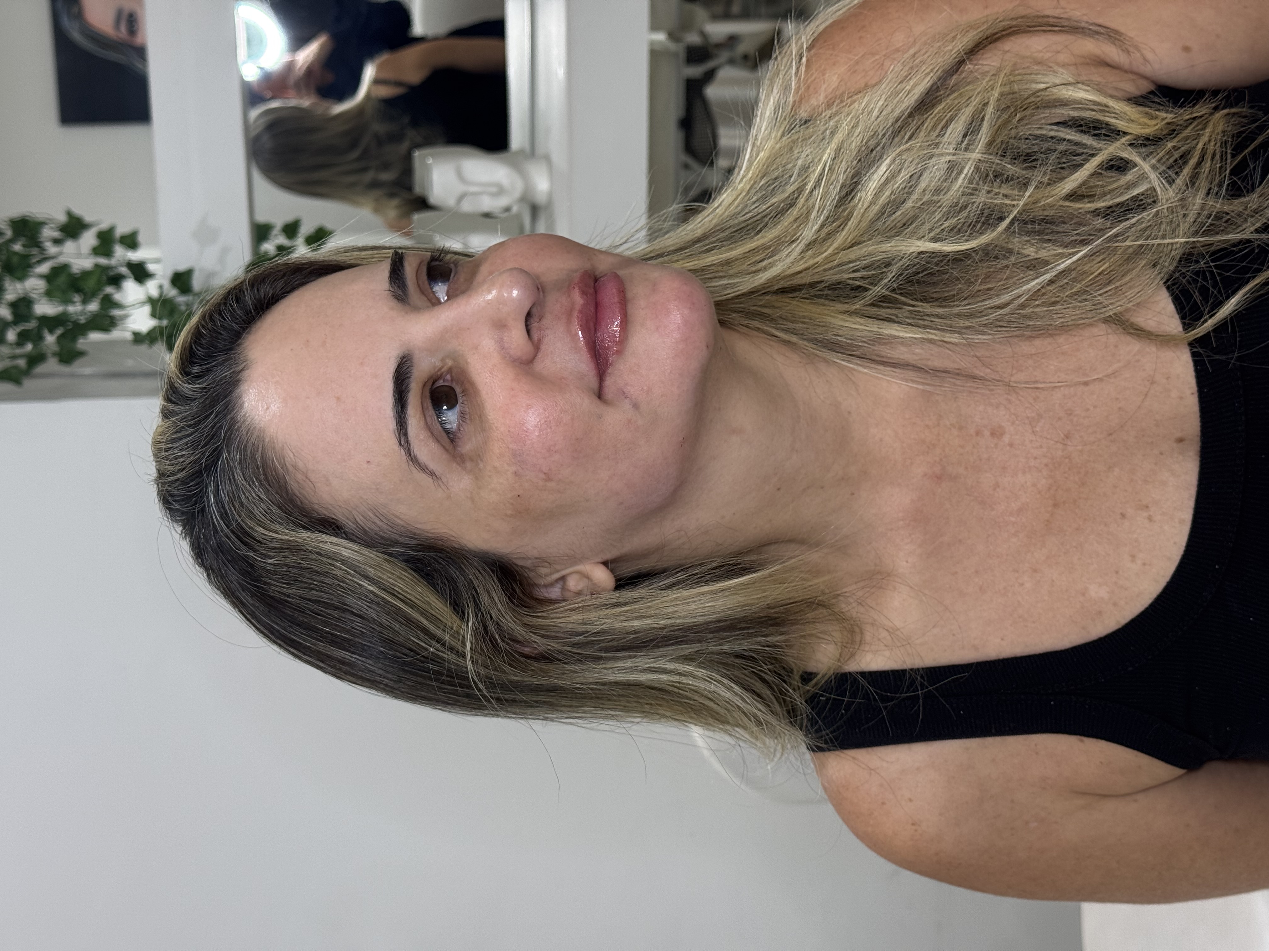 Resultado após procedimento