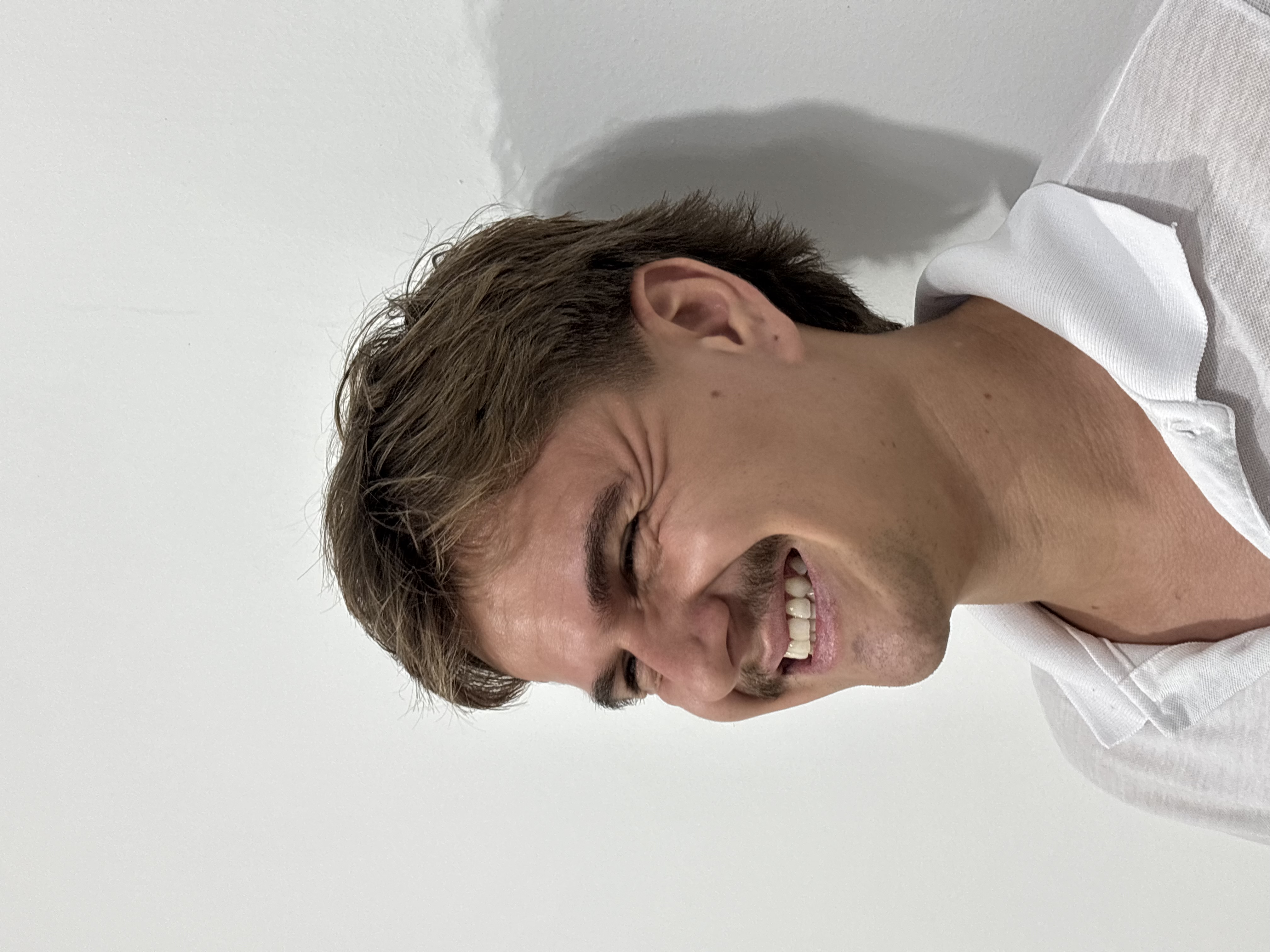 Antes do procedimento