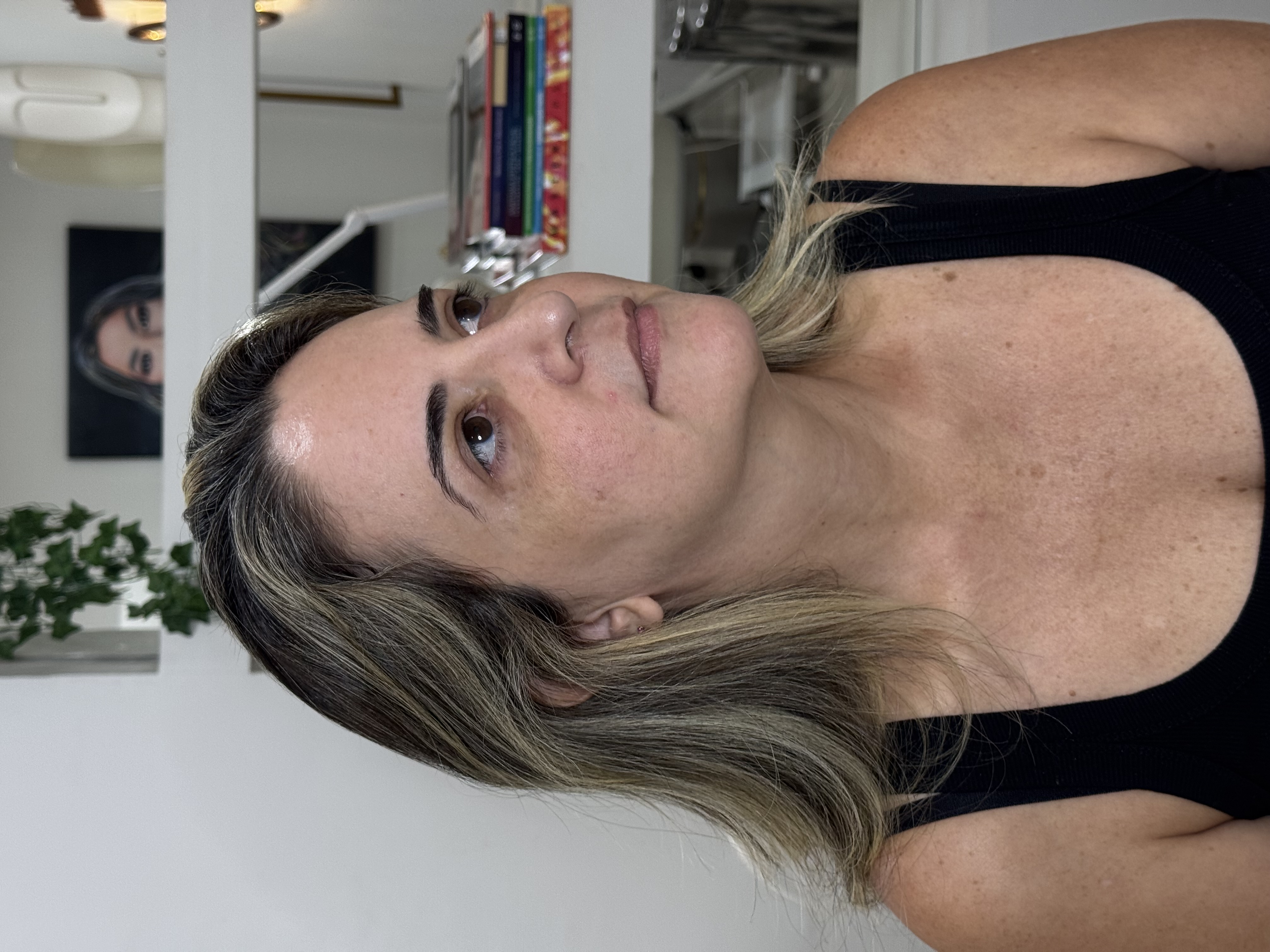 Antes do procedimento