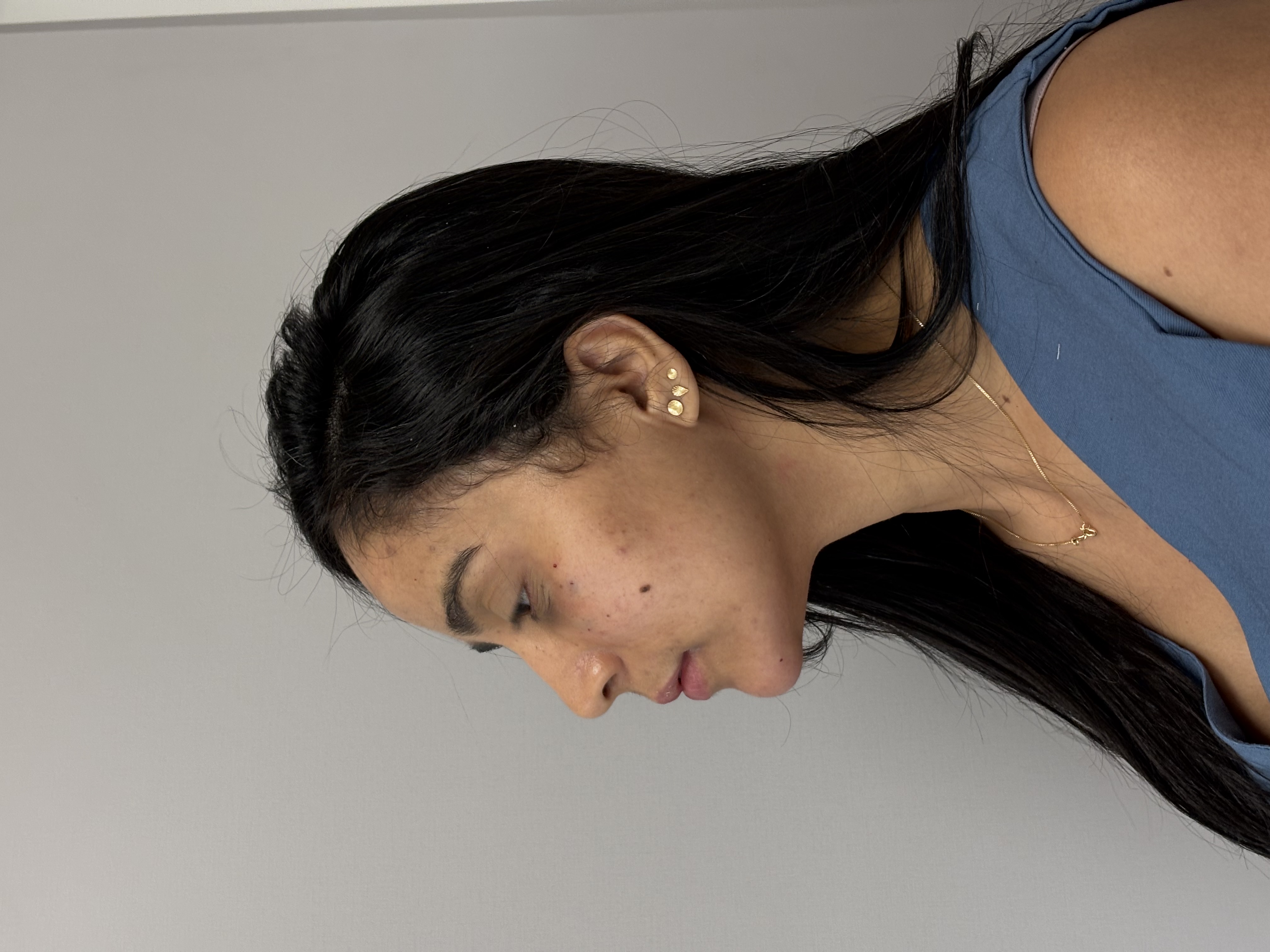 Resultado após procedimento